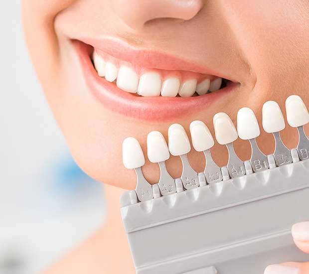 Dumont Dental Veneers and Dental Laminates